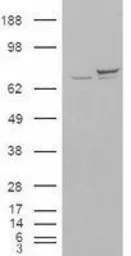 Anti-Ku70 antibody, N-term used in Western Blot (WB). GTX89026