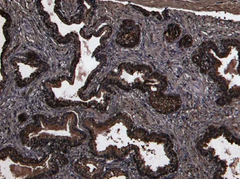Anti-CD26 antibody, Internal used in IHC (Paraffin sections) (IHC-P). GTX89027