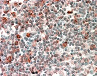 Anti-NCF4 antibody, Internal used in IHC (Paraffin sections) (IHC-P). GTX89030