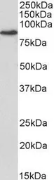 Anti-Transglutaminase 2 antibody, Internal used in Western Blot (WB). GTX89037