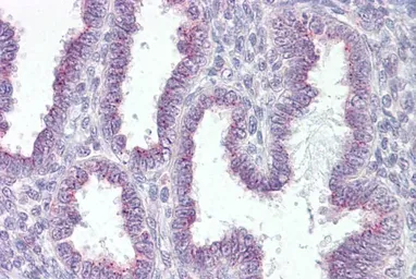 Anti-RER1 antibody, C-term used in IHC (Paraffin sections) (IHC-P). GTX89039