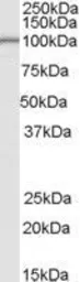 Anti-LARP2 antibody, Internal used in Western Blot (WB). GTX89042