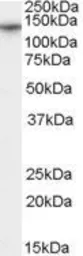 Anti-CACNA2D1 antibody, Internal used in Western Blot (WB). GTX89045