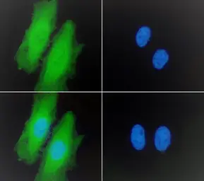 Anti-PGC1 alpha antibody, Internal used in Immunocytochemistry/ Immunofluorescence (ICC/IF). GTX89046