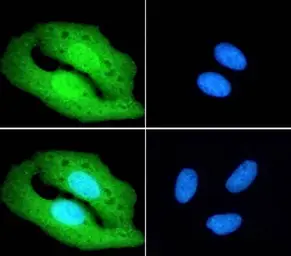 Anti-PGC1 alpha antibody, Internal used in Immunocytochemistry/ Immunofluorescence (ICC/IF). GTX89046