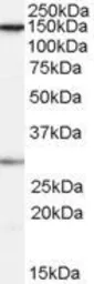 Anti-SUPT16H antibody, Internal used in Western Blot (WB). GTX89051