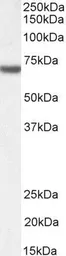 Anti-FANCG antibody, C-term used in Western Blot (WB). GTX89053