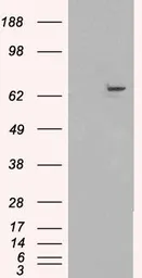 Anti-FANCG antibody, C-term used in Western Blot (WB). GTX89053