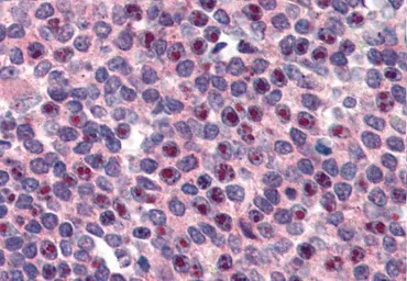 Anti-FANCG antibody, C-term used in IHC (Paraffin sections) (IHC-P). GTX89053