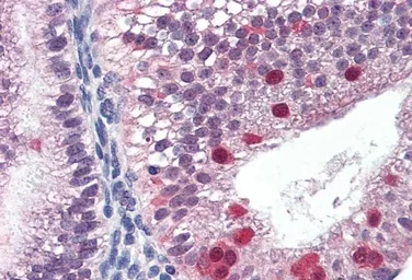 Anti-FANCG antibody, C-term used in IHC (Paraffin sections) (IHC-P). GTX89053