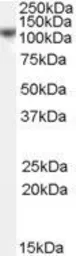 Anti-BRRN1 antibody, C-term used in Western Blot (WB). GTX89054