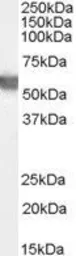Anti-G6PD (aa 308 - 320) antibody, Internal used in Western Blot (WB). GTX89057