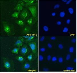 Anti-TIA1 antibody, Internal used in Immunocytochemistry/ Immunofluorescence (ICC/IF). GTX89059