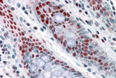 Anti-NAT10 antibody, Internal used in IHC (Paraffin sections) (IHC-P). GTX89062