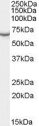 Anti-PCK1 antibody, Internal used in Western Blot (WB). GTX89064