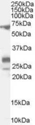 Anti-SALL4 antibody, Internal used in Western Blot (WB). GTX89069