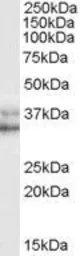 Anti-Nanog antibody, C-term used in Western Blot (WB). GTX89079