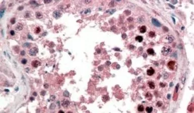 Anti-Nanog antibody, C-term used in IHC (Paraffin sections) (IHC-P). GTX89079