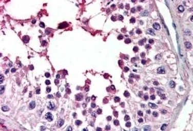 Anti-PIAS2 antibody, Internal used in IHC (Paraffin sections) (IHC-P). GTX89083