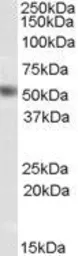 Anti-NR0B1 antibody, Internal used in Western Blot (WB). GTX89086