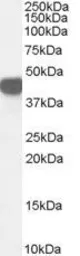 Anti-ASS1 antibody, Internal used in Western Blot (WB). GTX89088