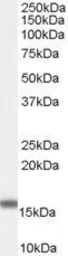 Anti-FABP2 antibody, C-term used in Western Blot (WB). GTX89090