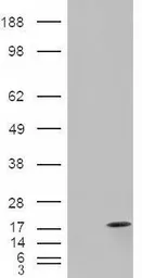 Anti-FABP2 antibody, C-term used in Western Blot (WB). GTX89090
