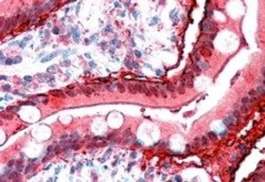 Anti-FABP2 antibody, C-term used in IHC (Paraffin sections) (IHC-P). GTX89090