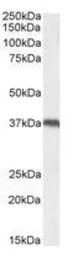 Anti-UCP2 antibody, Internal used in Western Blot (WB). GTX89094