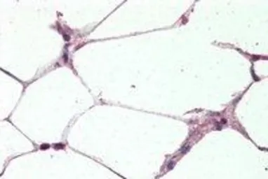 Anti-UCP2 antibody, Internal used in IHC (Paraffin sections) (IHC-P). GTX89094