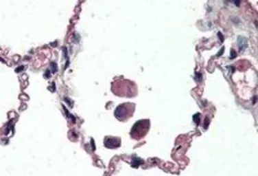 Anti-UCP2 antibody, Internal used in IHC (Paraffin sections) (IHC-P). GTX89094