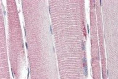 Anti-UCP2 antibody, Internal used in IHC (Paraffin sections) (IHC-P). GTX89094