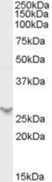 Anti-PSME2 antibody, C-term used in Western Blot (WB). GTX89096