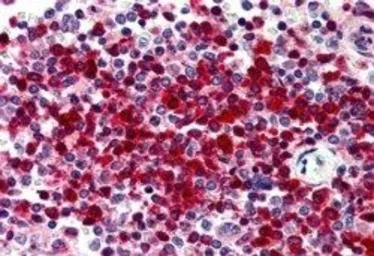 Anti-DKC1 antibody, Internal used in IHC (Paraffin sections) (IHC-P). GTX89097