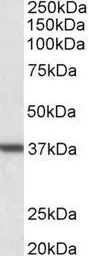 Anti-Arginase 1 antibody, C-term used in Western Blot (WB). GTX89098