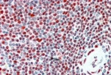 Anti-ILF2 antibody, Internal used in IHC (Paraffin sections) (IHC-P). GTX89104