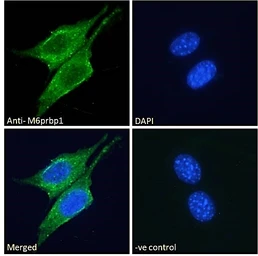 Anti-TIP47 antibody, Internal used in Immunocytochemistry/ Immunofluorescence (ICC/IF). GTX89106