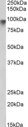 Anti-Neuroligin 2 antibody, Internal used in Western Blot (WB). GTX89107