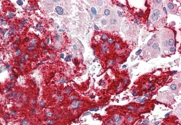 Anti-Neuroligin 2 antibody, Internal used in IHC (Paraffin sections) (IHC-P). GTX89107
