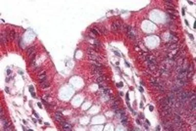 Anti-Perilipin 1 antibody, Internal used in IHC (Paraffin sections) (IHC-P). GTX89109