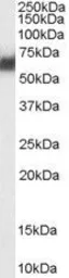 Anti-PDIA2 / PDIP antibody, Internal used in Western Blot (WB). GTX89110