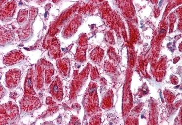 Anti-PDIA2 / PDIP antibody, Internal used in IHC (Paraffin sections) (IHC-P). GTX89110