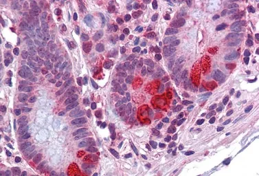 Anti-PDIA2 / PDIP antibody, Internal used in IHC (Paraffin sections) (IHC-P). GTX89110