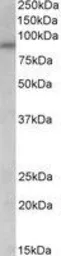 Anti-AVPR1A antibody, Internal used in Western Blot (WB). GTX89114