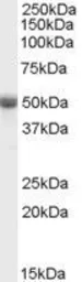 Anti-TRAF2 antibody, C-term used in Western Blot (WB). GTX89120