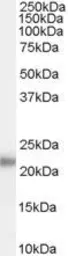 Anti-Kallikrein 2 antibody, Internal used in Western Blot (WB). GTX89122
