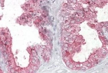 Anti-Kallikrein 2 antibody, Internal used in IHC (Paraffin sections) (IHC-P). GTX89122