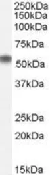 Anti-NAC1 antibody, Internal used in Western Blot (WB). GTX89124