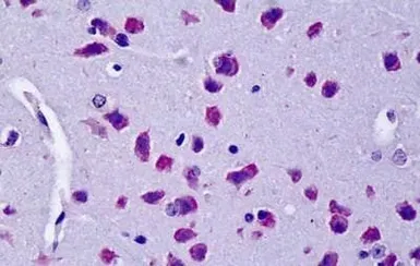 Anti-CYLD antibody, Internal used in IHC (Paraffin sections) (IHC-P). GTX89126