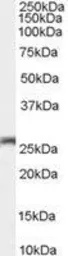 Anti-Connexin 26 antibody, C-term used in Western Blot (WB). GTX89128